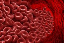 Kako prepoznati i lečiti anemiju?