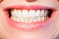 9 stvari koje morate da znate o zubima!